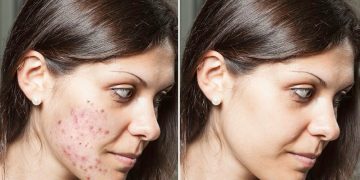 The Ultimate Guide to Treating Skin Conditions: Tips, Remedies, and Products