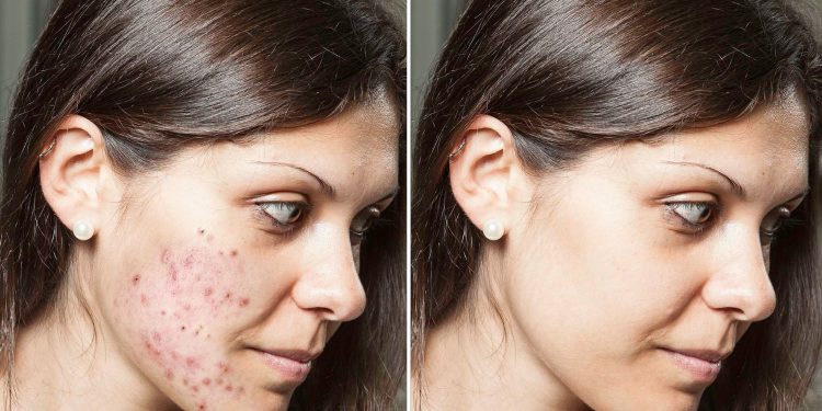 The Ultimate Guide to Treating Skin Conditions: Tips, Remedies, and Products