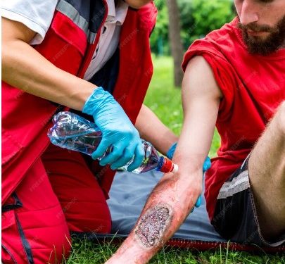 The Essentials of a Snake Bite First Aid Kit in Australia