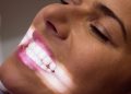 Professional Teeth Whitening in Minneapolis
