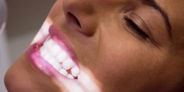 Professional Teeth Whitening in Minneapolis