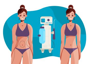 What to Consider Before Undergoing Fat Freezing in Melbourne