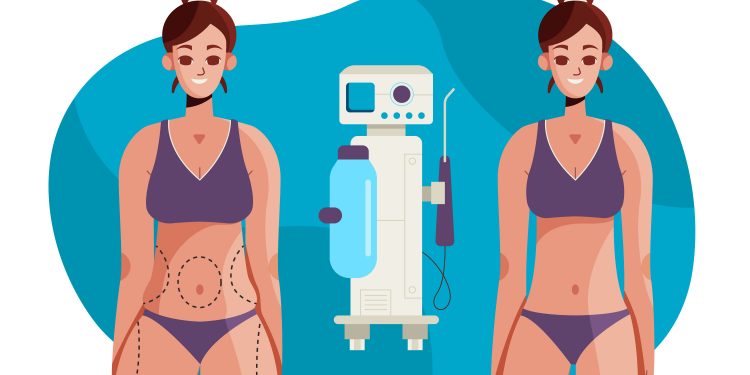What to Consider Before Undergoing Fat Freezing in Melbourne
