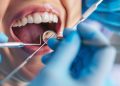 Exploring the World of Cosmetic Dentistry: Achieving Your Dream Smile