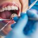 Exploring the World of Cosmetic Dentistry: Achieving Your Dream Smile