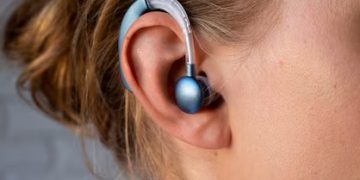 Hearing Aids Fort Myers FL: Your Affordable Hearing Solution