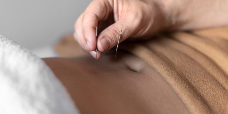 The Benefits of Combining Western and Eastern Medicine in Fertility Treatments